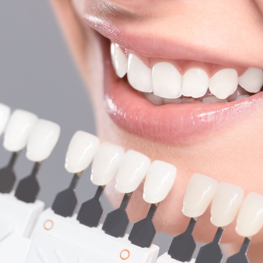 Expert dental bridge treatment at Mary St Dental Gympie providing comprehensive tooth replacement solutions with precision craftsmanship