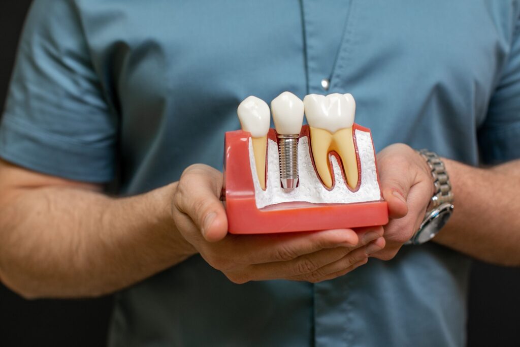 Dental crowns and porcelain veneers comparison at Mary St Dental Gympie for cosmetic dentistry and smile restoration