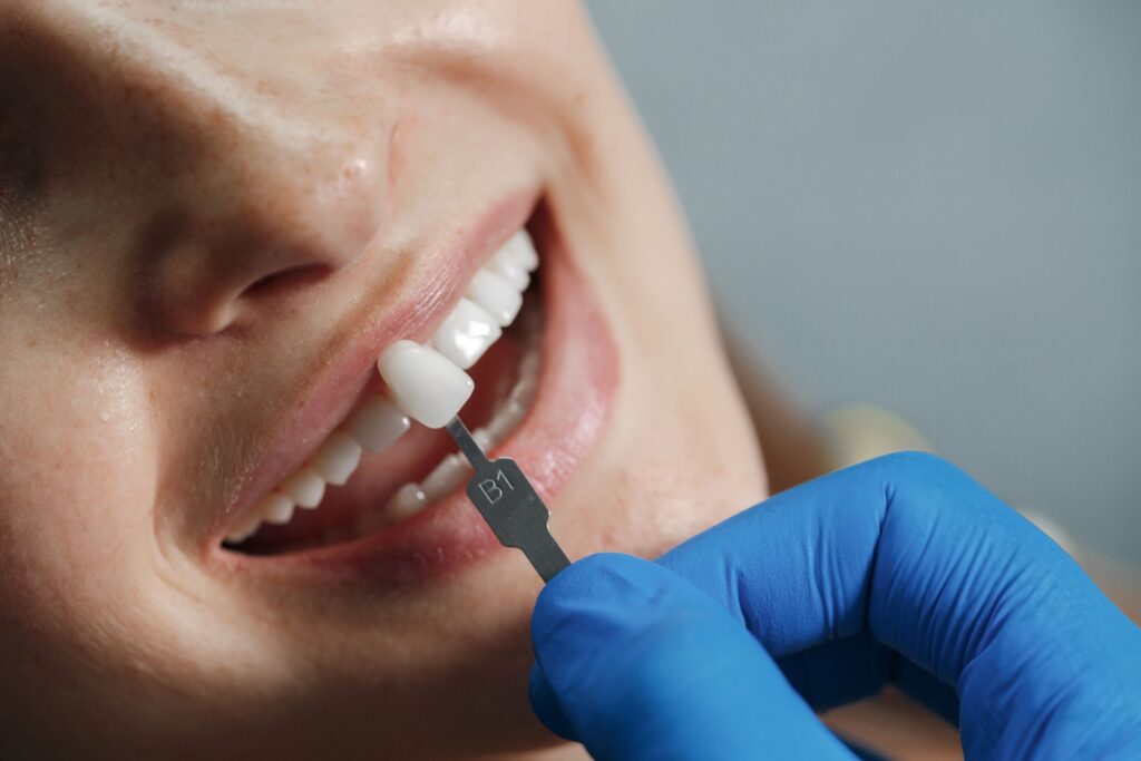 Dental implants treatment for Rainbow Beach patients at Mary St Dental Gympie for permanent tooth replacement solutions