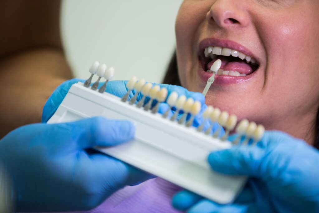 Modern dental crowns for Kilkivan residents at Mary St Dental Gympie providing durable tooth restoration solutions