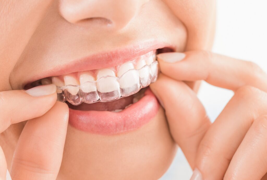 Set of dental bridges displayed on a blue support, representing restorative dental options at Mary St Dental Gympie
