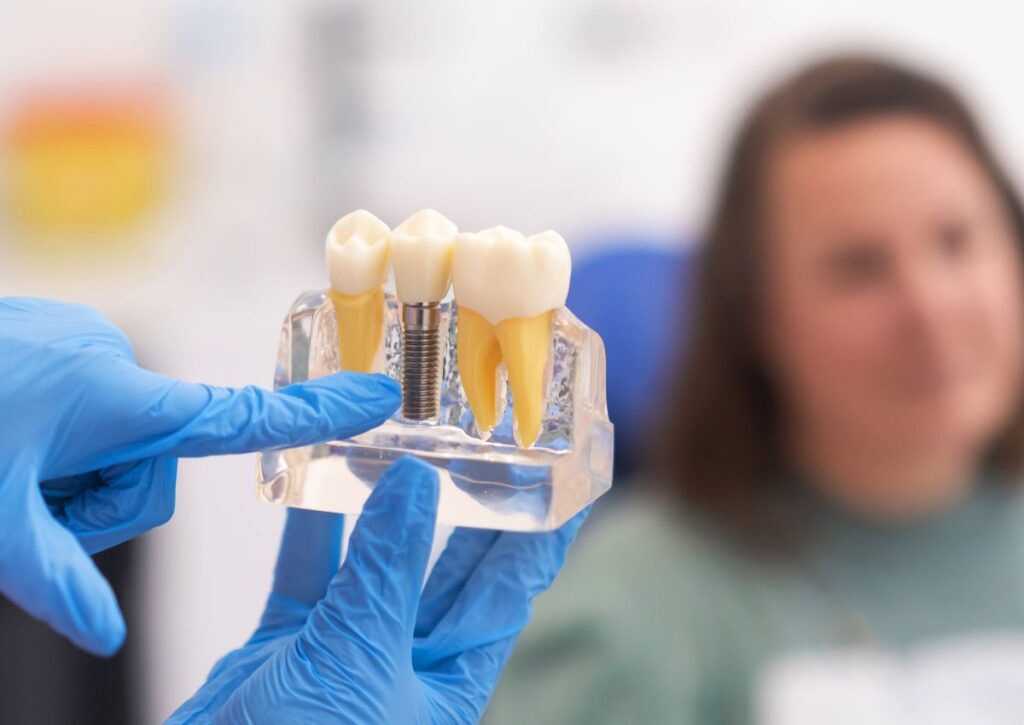 Dental implant model demonstrating tooth replacement for patients in Rainbow Beach