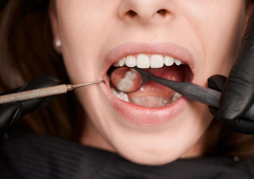 A patient holding a clear Invisalign aligner used to straighten teeth. Invisalign vs braces is a common comparison for adults in Gympie choosing orthodontic treatment to improve their smile.