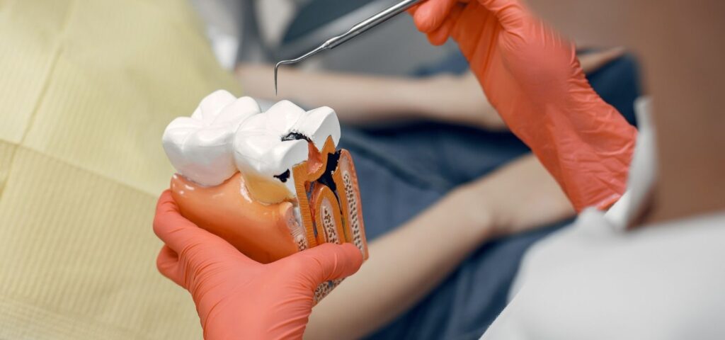 Root canal treatment at Mary St Dental Gympie
