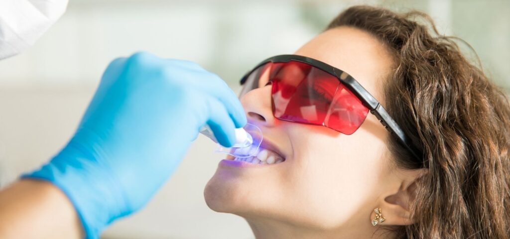 Professional teeth whitening service at Mary St Dental Gympie